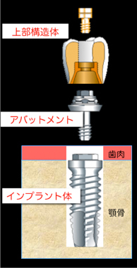 d4
